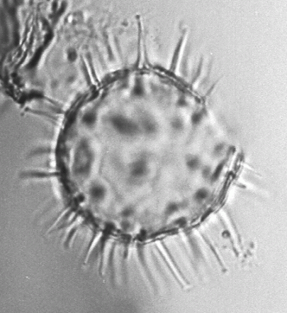 Lingulodinium machaerophorum is a dinoflagellate cyst first described by Deflandre and Cookson. From UCL.